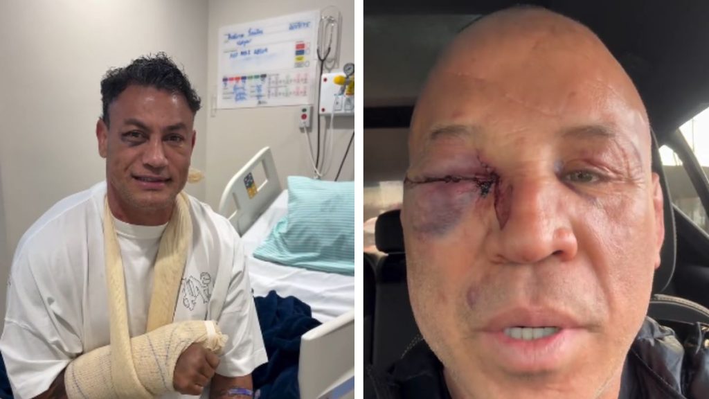 Wanderlei Silva anuncia que vai à justiça contra Popó após confusão